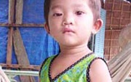 Bé gái 2 tuổi bị mẹ và cha dượng hành hung