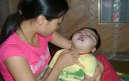 Hãy cứu lấy cháu bé bị dị tật não