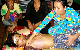 Giang - Thơm đòi giám định lại thương tật cháu Hào Anh