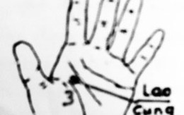 Cách tự bấm huyệt tay chữa vô sinh ở nam giới