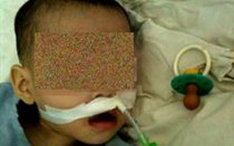 Bé 1 tuổi tắc đường thở vì núm vú nhựa