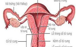 5 trường hợp bất thường ở tử cung