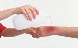 Không nên chườm lạnh vết thương 