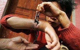 Bị xích cuốn chặt vào thịt cổ tay