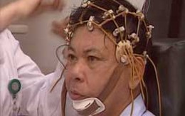 Đau cổ, vai - bệnh của dân văn phòng
