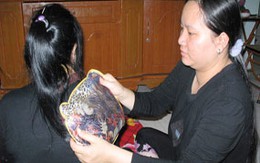Đừng xoa bóp khi bị đau khớp 
