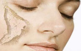 3 điều cần biết về sức khỏe mùa đông