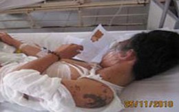 Học sinh lớp 10 bị tạt axít ngay tại nhà