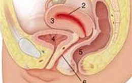 Nghiên cứu mới điều trị lạc nội mạc tử cung