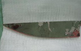 Bé 5 tuổi bị kính đâm xuyên mông 15cm
