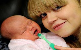 Bé gái mới chào đời đã có 2 răng cửa