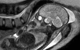 Ảnh scan đầu tiên trên thế giới về giây phút bé chào đời