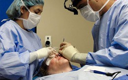 Căng da trán giúp trẻ lại 15 tuổi