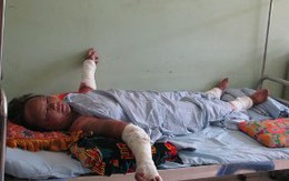 Nỗi đau của người mẹ bị con tuới xăng đốt 