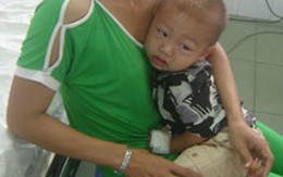 Cứu bé 20 tháng uống nhầm thuốc rửa vàng