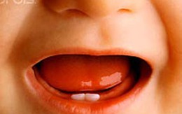 Chậm mọc răng có phải còi xương?