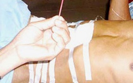 Những tai nạn hy hữu năm 2010