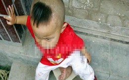 Mọc chân thứ 3 ở giữa háng