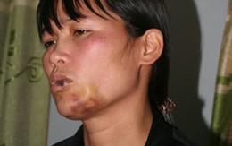 “Nhân viên nhà hàng tố bị khách hiếp dâm”: Các nhân chứng vụ án nói gì 