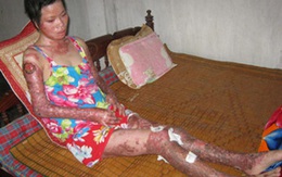 Quãng đời tăm tối của một thiếu nữ