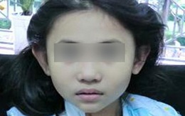 Bệnh viêm mạch máu cấp tính tấn công trẻ em