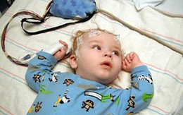 Bé 1 tuổi phải cắt bỏ một nửa não