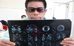 Thủ trưởng "nện" gẫy răng nhân viên