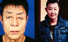 29 tuổi trông như ông lão 80 