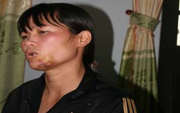 Vụ "Nhân viên nhà hàng tố bị khách hiếp dâm": CQĐT Bộ đội biên phòng lấy lời khai bị hại