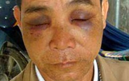Thầy giáo hành hung dã man bố vợ
