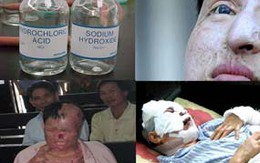 Hại vợ vì ghen “gió”