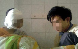 Chăm vợ sắp cưới bị tạt axít 