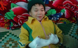 Phải tháo hai đốt ngón tay do nghịch pháo