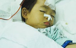Cha chém con gái 2 tuổi nứt sọ não