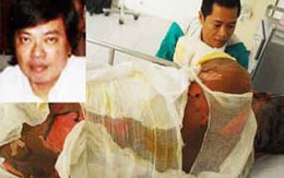 Ráo riết truy tìm thủ phạm đốt nhà báo