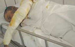 Nghi vấn quanh vụ nhà báo bị đốt trên giường ngủ