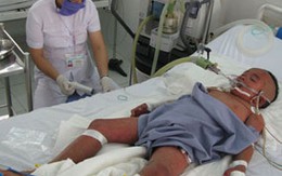 Cứu bé 5 tuổi có nhóm máu cực hiếm