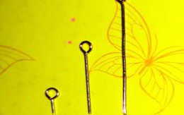 Cứu bé 2 tuổi nuốt đinh dài 3 cm