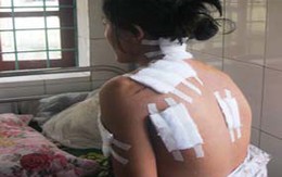 Vụ chồng ghen chém vợ 8 nhát: Hậu quả của sự cam chịu