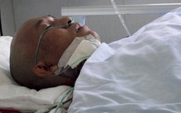 Sống chung với lưỡi dao trong đầu 4 năm