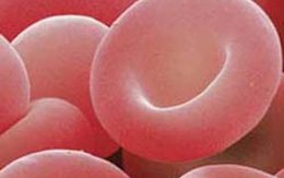 Nhóm máu tiết lộ sức khỏe của bạn