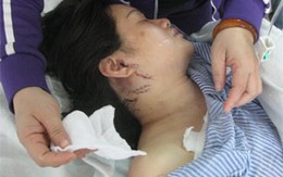 Bi kịch chuyện "không chịu nối lại tình xưa"