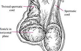 Cứu bé 3 tuổi bị cắt một bên tinh hoàn