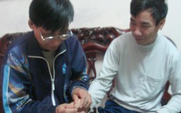Dị nhân đa tài: Nhìn móng tay đoán bệnh