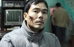 Côn đồ hành hung dã man người dân