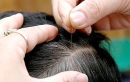 Không nên nhổ tóc bạc nhiều