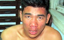Tên cướp dây chuyền sa lưới 'hiệp sĩ'