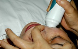 Dùng thuốc trị nám cấp tốc dễ bị giãn mạch