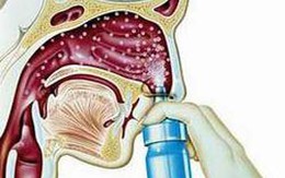 Cách dùng thuốc xịt mũi họng 