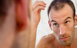 Thuốc chống rụng tóc khiến giảm ham muốn